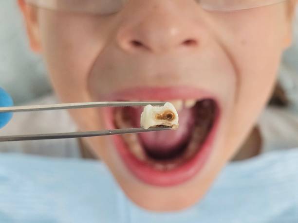 Best Same-Day Emergency Dentist in Crozet, VA